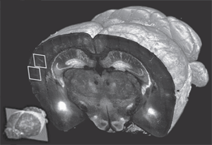 3D zobrazení části mozku myši zachycené prostřednictvím STP tomografie objektivem (20x) při rozlišení půl mikronu. zobrazení mozku prostřednictvím STP tomografie