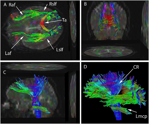 Traktografie